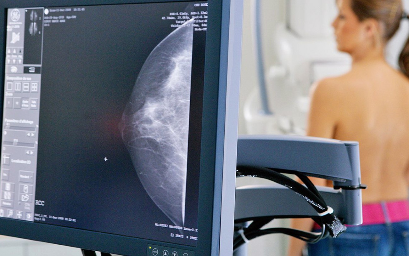 exame-mamografia